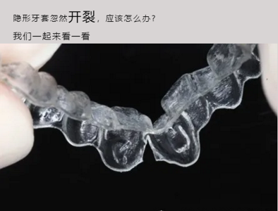 隐形牙套忽然开裂，我该怎么办?