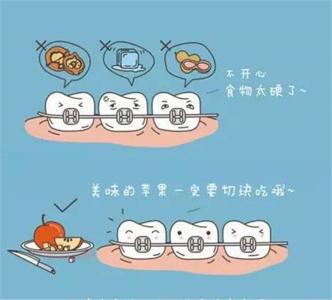 正畸饮食的正确打开方式