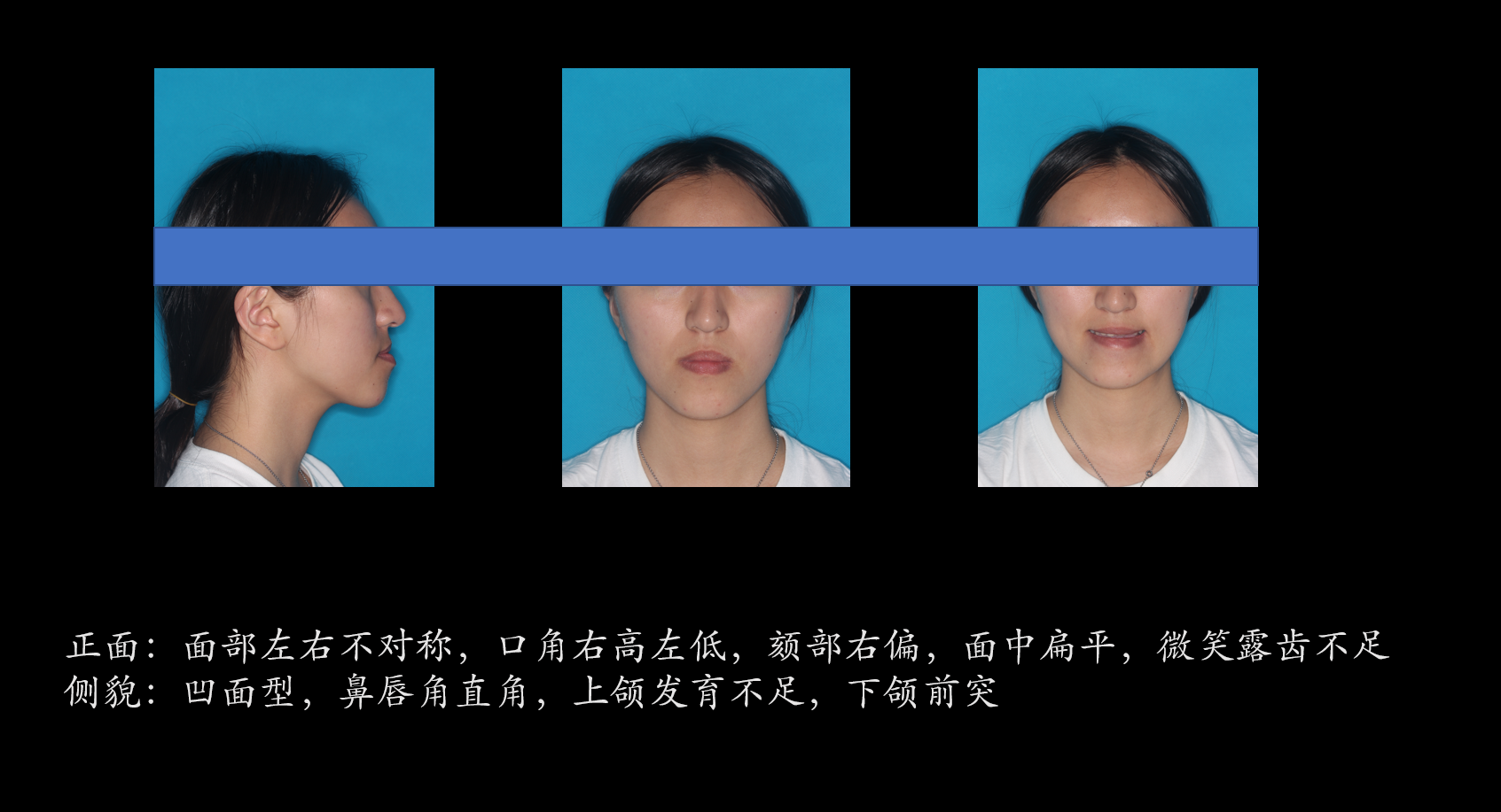 9a03336233f52fef082c812ea0adec8.png
