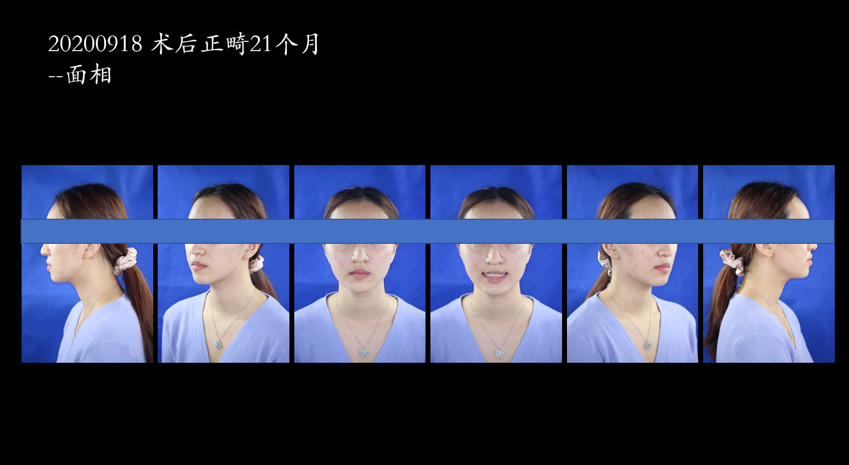 e0075a12c98a76c52e5689a6448ac95.png