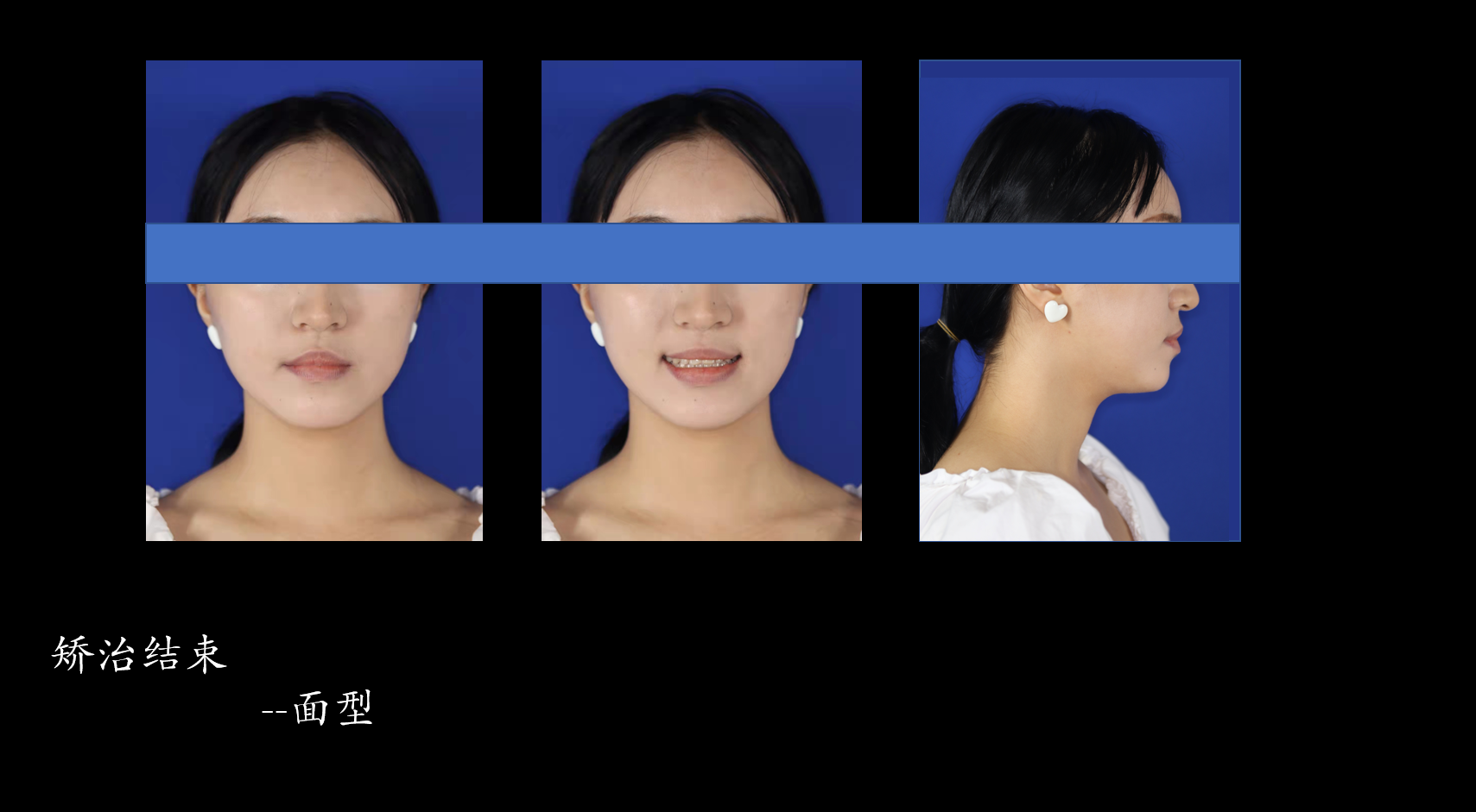 bec86cb50b74e0df77541d195ab8b9d.png